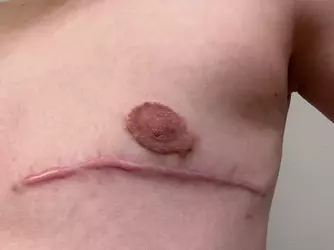 does-my-surgery-look-normal-v0-1zgrgmkinybf1.webp