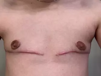 does-my-surgery-look-normal-v0-hixldnkinybf1.webp