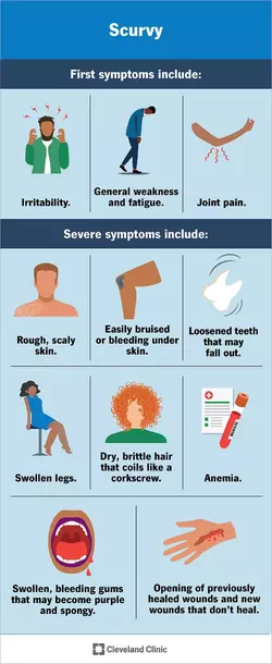 scurvy symptoms.webp