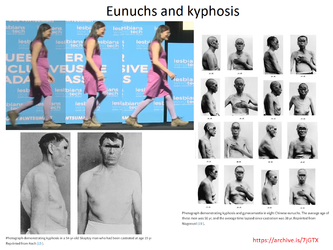 Troons Eunuchs and Kyphosis 1.webp