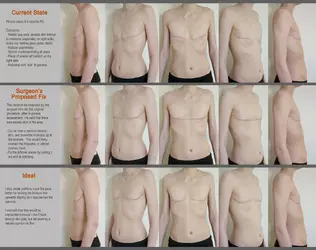 revision-proposal-for-excess-tissue-new-surgeon-or-original-v0-l7awkcksv2df1.webp