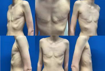 revision-proposal-for-excess-tissue-new-surgeon-or-original-v0-0yk5oa6sv2df1.webp
