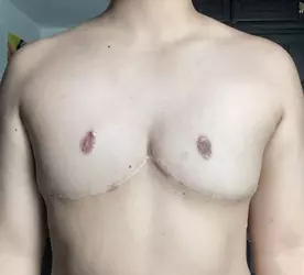 hivsqatxh3df1.webp