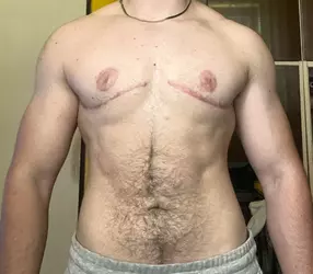 nipple-revision-opinions-wanted-v0-rl4cy0u1un8f1.webp