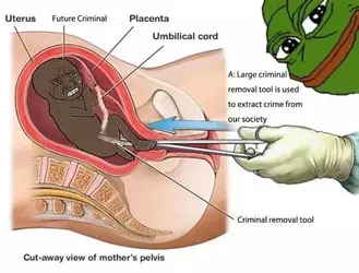 pepe-smug-abortion.webp