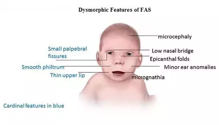 FASD_Slide1_600x305.webp