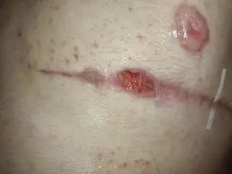 tw-open-wound-my-scars-dont-heal-v0-7c5q7svqvoef1.webp