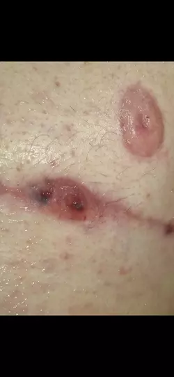 tw-open-wound-my-scars-dont-heal-v0-rftsmivqvoef1.webp