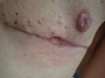 tw-open-wound-my-scars-dont-heal-v0-dazs8fvqvoef1.webp