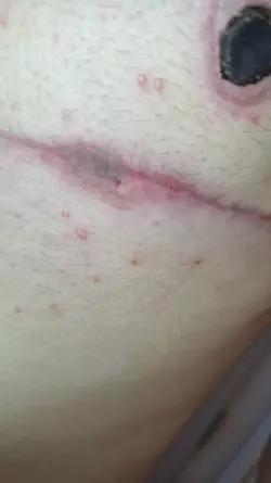tw-open-wound-my-scars-dont-heal-v0-f4juakvqvoef1.webp