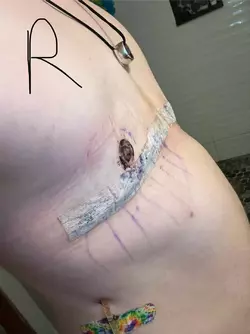 obligatory-are-my-nipples-okay-post-why-is-my-chest-caved-in-v0-kbbu727k1qff1.webp