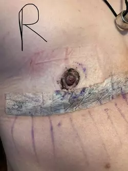 obligatory-are-my-nipples-okay-post-why-is-my-chest-caved-in-v0-vqq0hc7k1qff1.webp