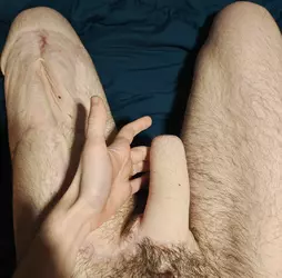 2-mo-post-debulking-implants-delayed-alt-v0-mmonq5lvs2gf1.webp