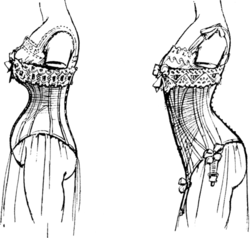 506px-Deformation_de_la_ligne_de_labdomen_et_des_reins_par_le_corset.png