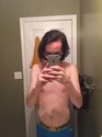 Aids_skrillex.jpg Aids_skrillex.jpg
