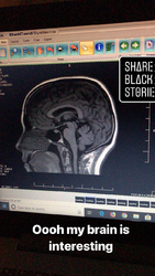 She Has a Brain.png