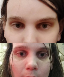 lukew cheeks jaw.png