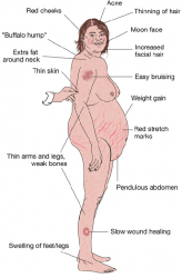 Signs-and-symptoms-of-Cushings-disease.png
