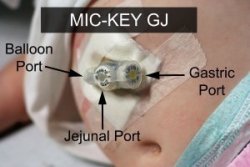 GJ-tube-labeled-300x200.jpg