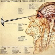 slavic_lobotomist