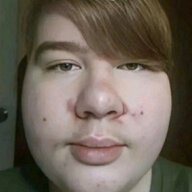 Autistic retard