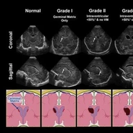 Germinal Matrix