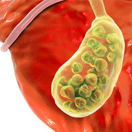 Gallstonesavior