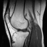 rightkneecap