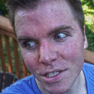 Gregscircumcisionscar