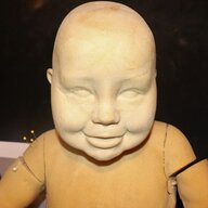 Malformed_Fetus