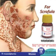 Scrofula