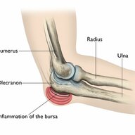 A Left Elbow