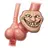 Itchy Hemorrhoids