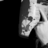Paintrick S Canlinson