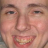 Cowlick